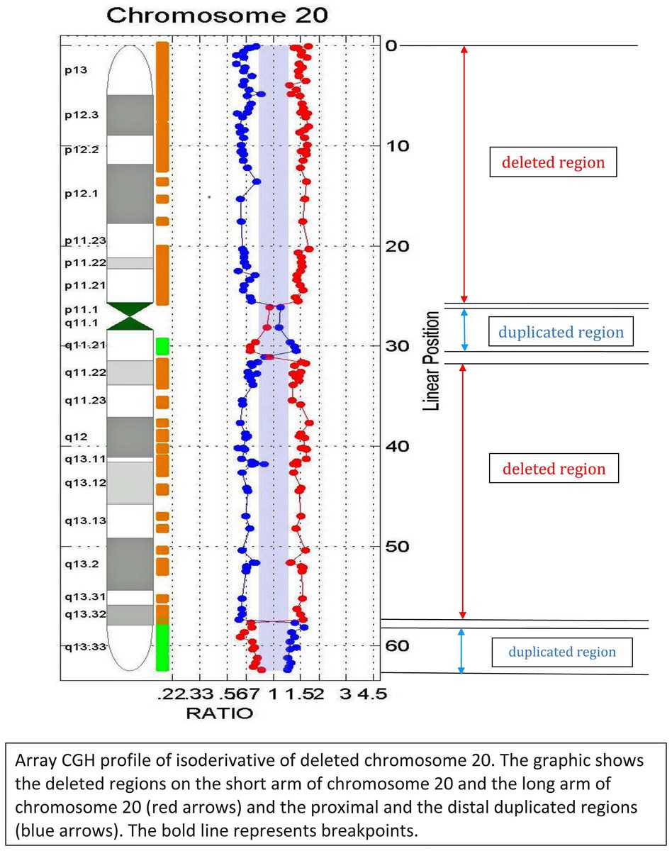 Array CGH profile of isoderivative of deleted chromosome 20.